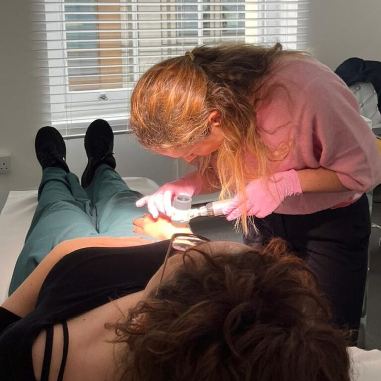 mole removal consultation by dr. nicki bystrzonowski at city dermatology clinic